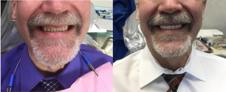 Smile Gallery. Dentist in Granger, IN. Dr. Thomas Anglemire, DDS, Dr. Ross J. Schafer, DDS. Granger Family Dentistry