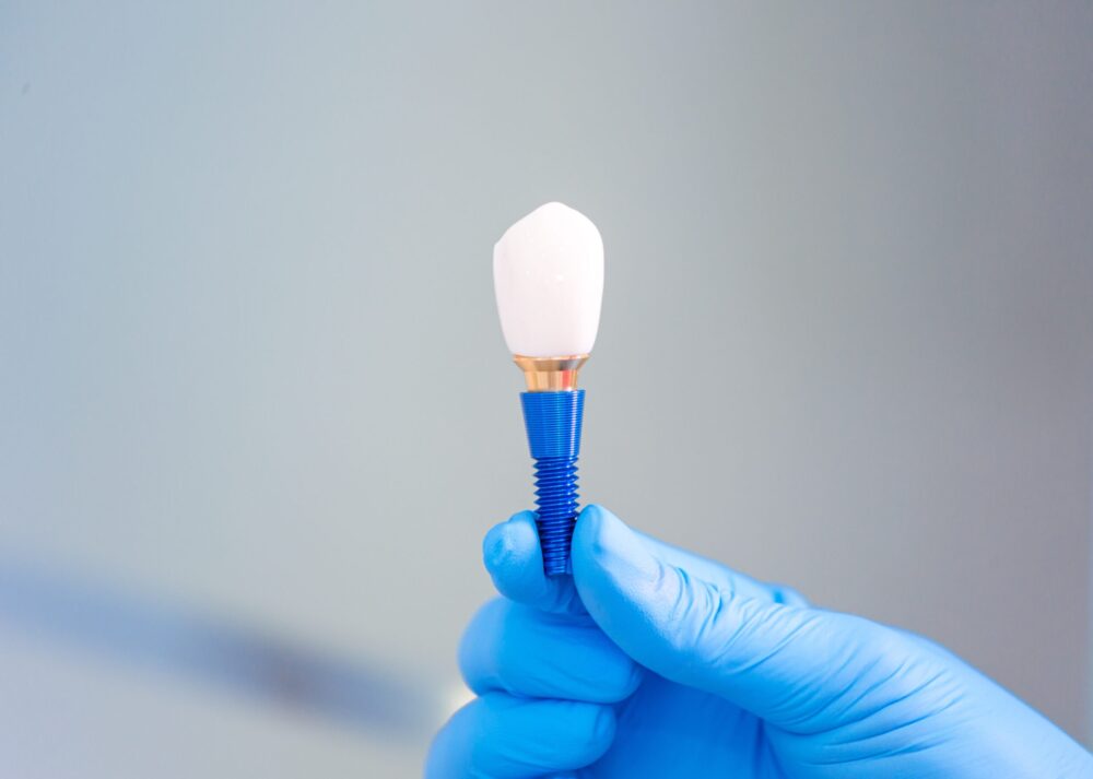 dental implants Granger
